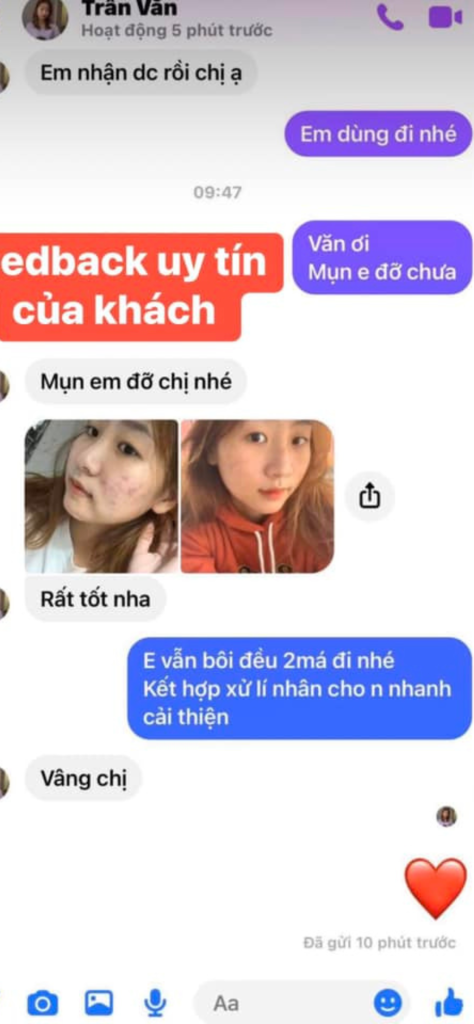 Feedback tri mun cua khach hang 4